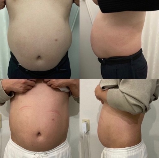 中古　売り切り価格☆ 次世代EMS エステサロン