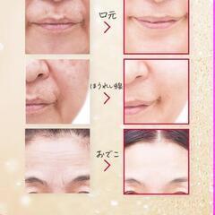 日焼け 母の日 Kira Bika シミ シワ 美白 定価5万円 95％OFF 正規品 化粧品 化粧水 の画像