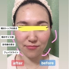 【限定10名★首肩ほぐし付き】小顔マッサージ💆‍♀️&スキンケア...