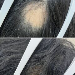 ◇男性限定◇完全プライベート空間の増毛サロン　増毛キャンペ…