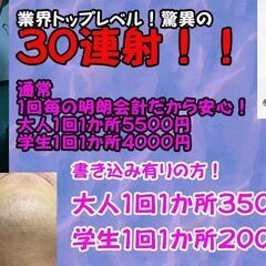 驚異の最新３０連射脱毛！！メンズ脱毛もオススメ