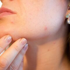 【オンラインでわかる！】肌トラブルでお悩みの方必見！必ず自信の持...