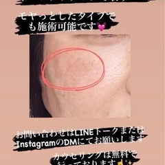 モヤっとしたシミに❣️