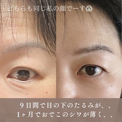 気になるお肌のお悩み改善へ