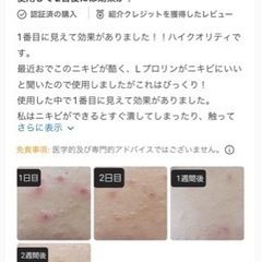 ニキビサプリ【iHerb】L-Proline【原価1,790円】の画像