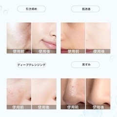 毛穴洗浄 毛穴ケア エステ ハイドラフェイシャル　業務用/家庭用の画像