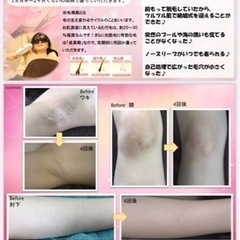 光脱毛　光フェイシャル　プライベートサロン　 - 地元のお店