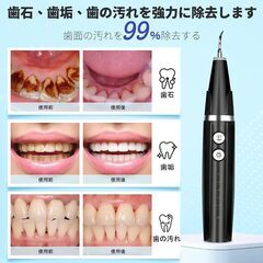 Sidik 超音波 歯間クリーナーの画像