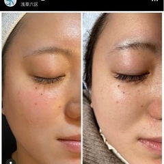 ⚡️韓国美容エステ⚡️プラズマシャワー専門店skin lab K...