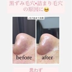 毛穴改善コース👃モニター価格¥6,600💕もうすぐ終了🙇‍♀️