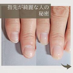 ＼最強のネイルケア／爪悩み解決！