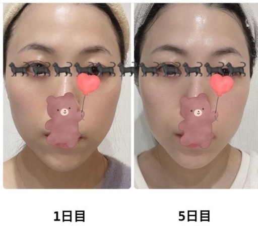 新品・未開封未使用！美顔器　ディレイアゼル　
