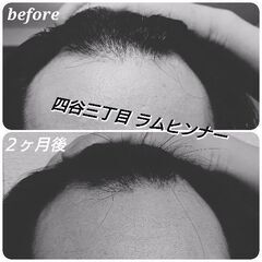 四谷三丁目徒歩２分プライベートサロン 髪質＆肌質改善！モニター様も募集！ − 東京都