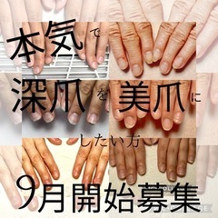かなりの深爪・噛み癖の方のみ募集