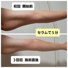 💎9月限定💎むくみチェック測定会💪🦵✨の画像