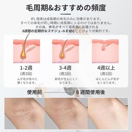 脱毛器