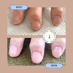 お得に体験♩《自爪育成》通常1回8,400円→4,500円税込