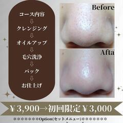 大人気✨毛穴洗浄￥3,000♥(お顔全体コース♥)