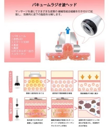 キャビテーション　エステ