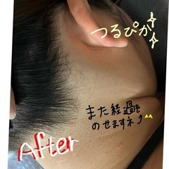 脱毛 全身脱毛 ¥7,000 - 美容