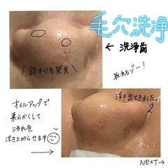 脱毛 全身脱毛 ¥7,000 − 沖縄県