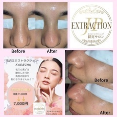 毛穴エクストラクション(毛穴洗浄) 6600円❣️