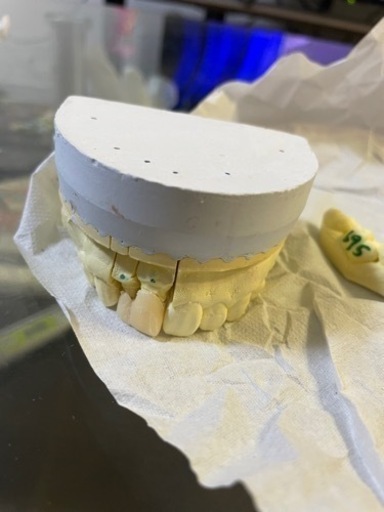 僕の大事な歯型です