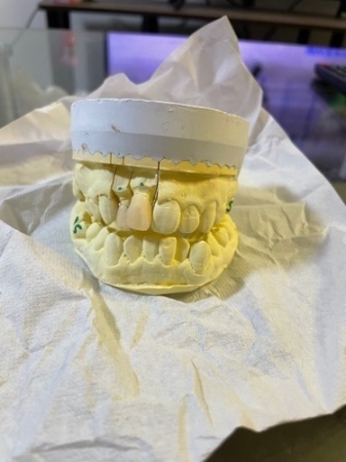 僕の大事な歯型です