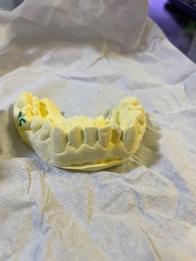 僕の大事な歯型です