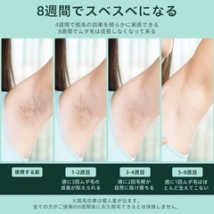プレゼントなどに★【新品未使用】IPL光脱毛器　100万回照射の画像