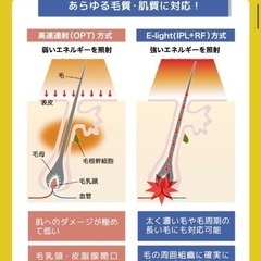値下！【美品】業務用ハイスペック脱毛器＋施術台備品セット　ライエンス２　高速10連射脱毛E-light「IPL」搭載ライエンスツー  SHR(最大高速10連射)で日焼けも産毛にも施術可能。毛周期にもとらわれない脱毛法IPL+ラジオ波のE-Light(単発打ち)も搭載しているため、オールマイティーな施術が可能となります。の画像