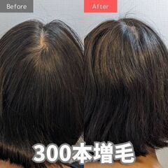 【先着3名様】増毛エクステ症例モニター募集（中央駅）