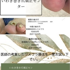 いわき巻き爪矯正センター