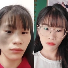 ❤️‍🔥あざ、怪我後の変色、色々の色素沈着、母斑悩みの相談…