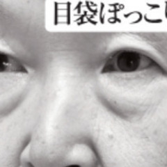 モデル募集【薄毛・シミ・シワ・たるみ・ポツポツ・ぽっちゃり・足のお悩み】の画像