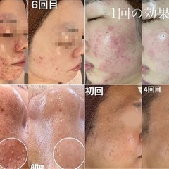 【未経験◎月給18万〜/ボーナス/昇給/インセンティブ豊富】エステティシャン大募集！の画像