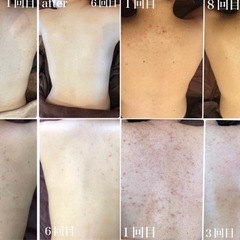 【未経験◎月給18万〜/ボーナス/昇給/インセンティブ豊富】エステティシャン大募集！の画像