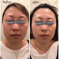 太田市龍舞町にあるフェイシャルエステサロンです。 - 美容