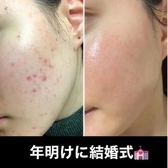 お肌のお悩み教えてください☺︎の画像