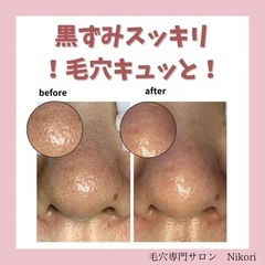 化粧崩れの方‼️皮脂詰まりが原因では❓