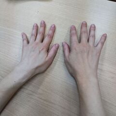 ヒト幹細胞培養液入りリフトアップスキンケア体験会