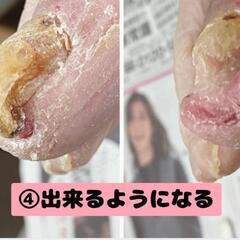 福祉爪ケア専門士認定講習のお知らせ①の画像