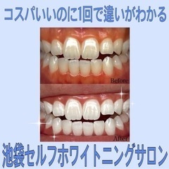 激安【75%割引】セルフホワイトニングのチケット3900円の画像