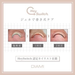 【モニター募集】ジェルで巻き爪ケア★