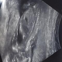 💞👶🍼8月に出産予定🍼👶💞