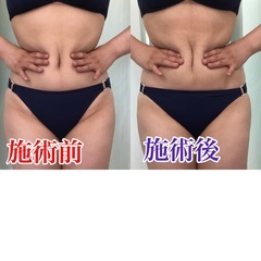 リンパ整体スクール　丁寧な個別指導　　血液パワーで自然治癒力を活性させる整体の画像