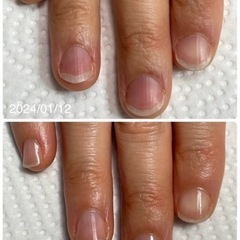 3ヶ月で美爪になれる！モニター募集