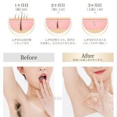 ♥️新品未使用♥️脱毛器 低温サファイア冷却 速い 痛くない 軽量 vio対応 だつもうき脱毛器 99万発5段階調節 自動照射 家庭用脱毛器 男女兼用
の画像