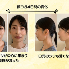 🔰顔ヨガ✨面長改善✨小顔✨頬コケ解消✨しわたるみ✨ほうれい線✨ マリオネットライン✨ゴルゴ線✨顔の歪み✨くすみ✨むくみ✨目の下のクマ✨まぶたのたるみ✨二重アゴ✨乾燥の画像