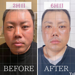 4/27(金)【限定受講料】🌴韓国小顔フェイシャル技術講座💜の画像